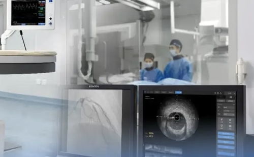 上半年45個創(chuàng)新醫(yī)療器械獲批，國產(chǎn)超聲設(shè)備向高端化邁進(jìn)